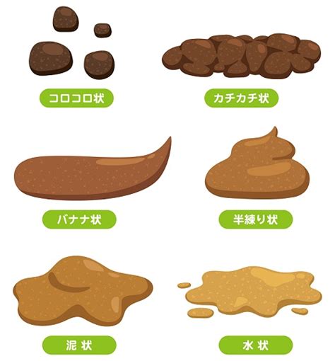 水便原因|消化器内科専門医が解説する下痢症〜下痢の定義、原因、症状と。